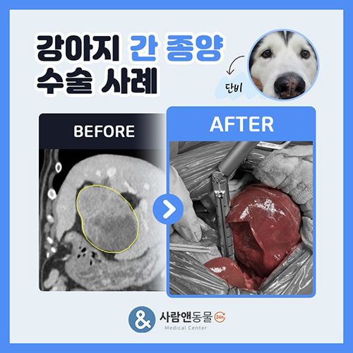 [간종양] 건강검진 중 우연히 발견된 강아지 간 종괴, 무조건 악성 종양일까요? 간엽 절제 수술의 이해